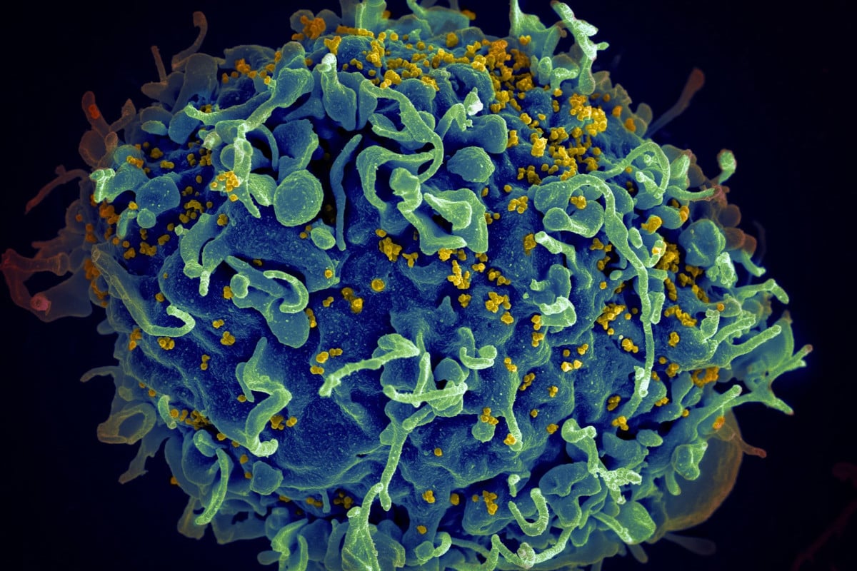 Close Up Of Blue Circular HIV Virus With Green Strands And Yellow Dots